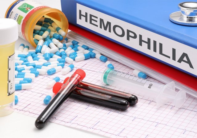 Hemofilie - ilustrační foto