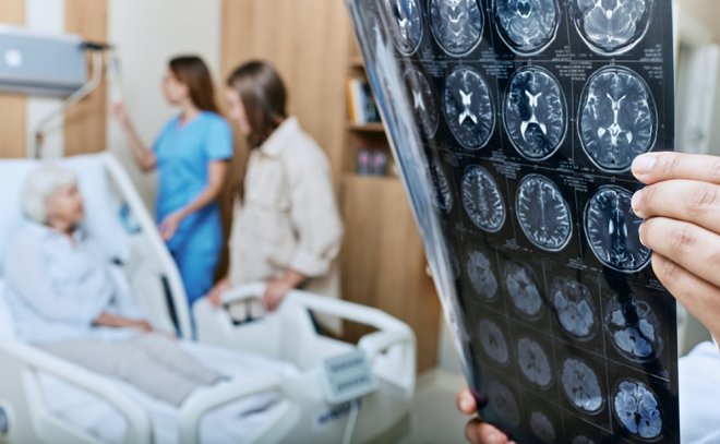 Alzheimerova demence: Dědičnost hraje roli!